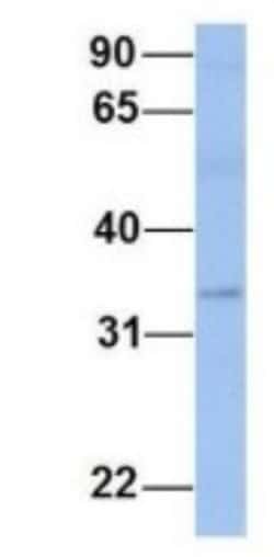 PAOX Antibody, Novus Biologicals 100μL; Unlabeled:Antibodies, Polyclonal