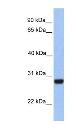 PAOX Antibody, Novus Biologicals 100μL; Unlabeled:Antibodies, Polyclonal