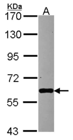 PAPD1 Antibody, Novus Biologicals 0.1mL; Unlabeled:Antibodies, Polyclonal