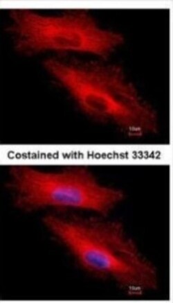 Mouse anti-PAPD1, Clone: 3D2, Novus Biologicals 0.1mg; Unlabeled:Antibodies,
