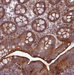 Papilin Antibody, Novus Biologicals 25 &mu;L, Unlabeled:Antibodies, Polyclonal