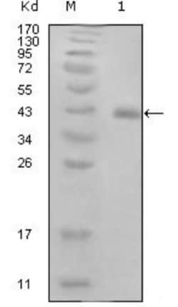 HPV16 E7 Antibody (3D6F1), Novus Biologicals 0.025 mL, Unconjugated:Antibodies,
