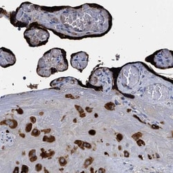 Pappalysin-2/PAPP-A2 Antibody, Novus Biologicals 0.1mL; Unlabeled:Antibodies,