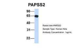 PAPSS2 Antibody, Novus Biologicals™