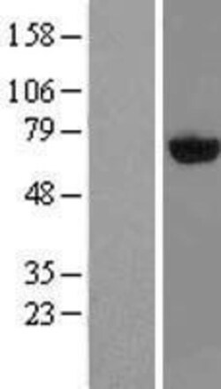 Novus Biologicals&trade;&nbsp;PAPSS2 Overexpression Lysate