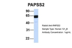 PAPSS2 Antibody, Novus Biologicals 100&mu;L; Unlabeled:Antikroppar