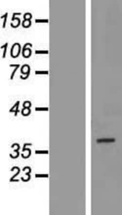 Novus Biologicals&trade;&nbsp;PAQR5 Overexpression Lysate
