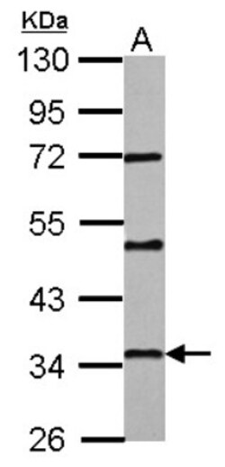 PAQR6 Antibody, Novus Biologicals 0.1mL; Unlabeled:Antibodies, Polyclonal