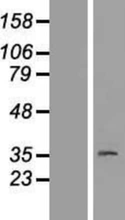 Novus Biologicals™ PAQR8 Overexpression Lysate