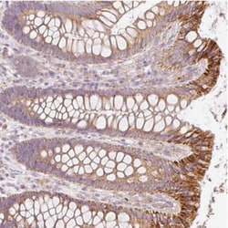 PAQR9 Antibody, Novus Biologicals 25ul | Buy Online | Novus Biologicals | Fisher Scientific