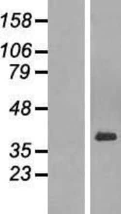 Novus Biologicals™ PARD6A Overexpression Lysate