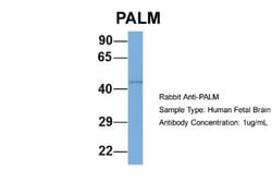 Paralemmin Antibody, Novus Biologicals 100&mu;L; Unlabeled:Antibodies,