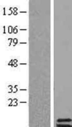 Novus Biologicals&trade;&nbsp;Parathyroid hormone 2 Overexpression Lysate