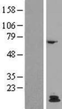 Novus Biologicals™ PTH Overexpression Lysate