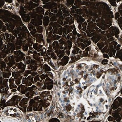 PTH2R Antibody, Novus Biologicals 25 &mu;L, Unlabeled:Antibodies, Polyclonal