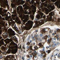 PTH2R Antibody, Novus Biologicals 25 &mu;L, Unlabeled:Antibodies, Polyclonal