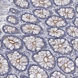 PARD3/Par3 Antibody, Novus Biologicals 0.1mL; Unlabeled:Antibodies, Polyclonal