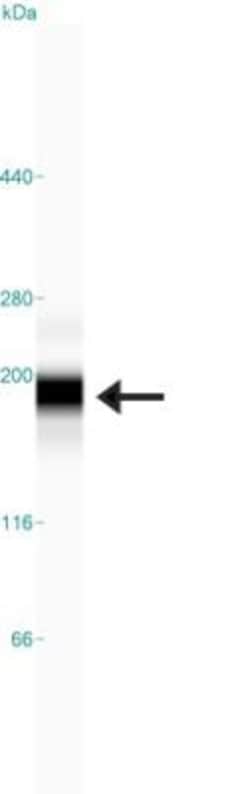 PARD3/Par3 Antibody, Novus Biologicals 0.1mL; Unlabeled:Antibodies, Polyclonal