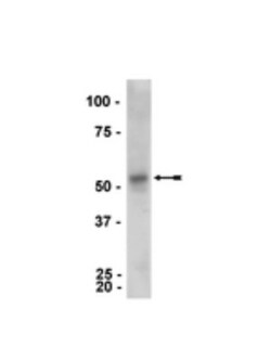 Parkin Antibody (PRK8), Novus Biologicals 0.025 mL; Unconjugated:Antibodies,