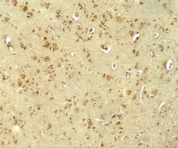 Parkin Antibody - BSA Free, Novus Biologicals 0.1mg; Unlabeled:Antibodies,