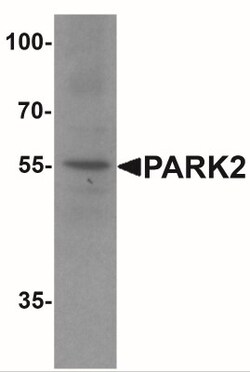 Parkin Antibody - BSA Free, Novus Biologicals 0.1mg; Unlabeled:Antibodies,
