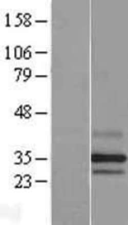 Novus Biologicals&trade;&nbsp;PARL Overexpression Lysate