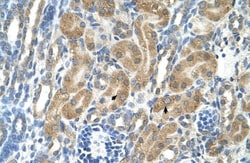PARL Antibody, Novus Biologicals 100 &mu;L | Buy Online | Novus Biologicals | Fisher Scientific