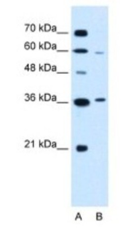 PARL Antibody, Novus Biologicals 100 &mu;L | Buy Online | Novus Biologicals | Fisher Scientific