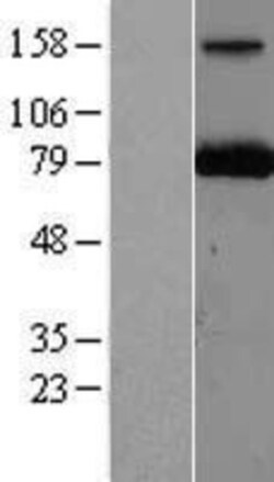 Novus Biologicals™ PARN Overexpression Lysate