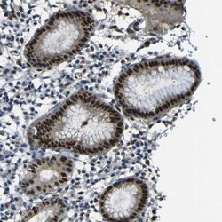 PARN Antibody, Novus Biologicals 0.1mL; Unlabeled:Antikörper