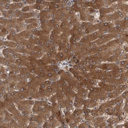 PARP11 Antibody, Novus Biologicals 25 &mu;L | Buy Online | Novus Biologicals | Fisher Scientific
