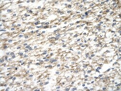 PARP12 Antibody, Novus Biologicals 0.05mg; Unlabeled:Antibodies, Polyclonal