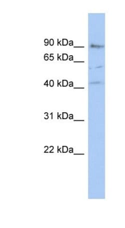 PARP12 Antibody, Novus Biologicals 0.05mg; Unlabeled:Antibodies, Polyclonal