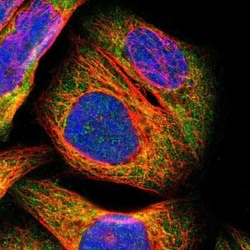 PARP14 Antibody, Novus Biologicals 0.1mL; Unlabeled:Antibodies, Polyclonal
