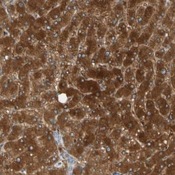 PARP14 Antibody, Novus Biologicals 0.1mL; Unlabeled:Antibodies, Polyclonal