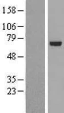 Novus Biologicals&trade;&nbsp;PARP3 Overexpression Lysate
