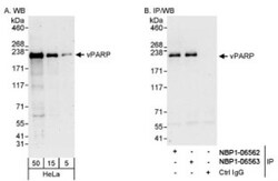 PARP4 Antibody, Novus Biologicals 0.1mL; Unlabeled:Antibodies, Polyclonal