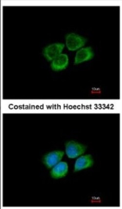 PARS2 Antibody, Novus Biologicals 0.1mL; Unlabeled:Antibodies, Polyclonal