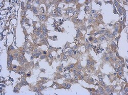 PARS2 Antibody, Novus Biologicals 0.1mL; Unlabeled:Antibodies, Polyclonal