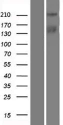 Novus Biologicals™ TICRR Overexpression Lysate