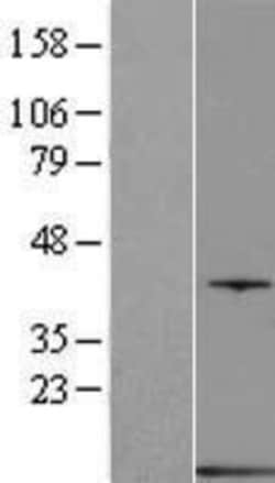 Novus Biologicals&trade;&nbsp;Parvalbumin Overexpression Lysate