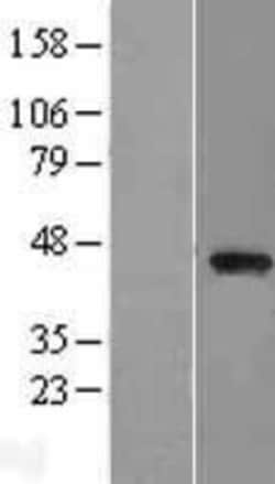 Novus Biologicals&trade;&nbsp;PARVB Overexpression Lysate