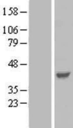 Novus Biologicals&trade;&nbsp;Parvin gamma Overexpression Lysate