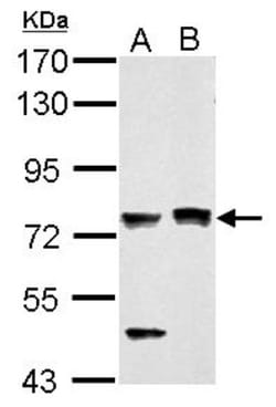 PASD1 Antibody, Novus Biologicals 0.1mL; Unlabeled:Antibodies, Polyclonal