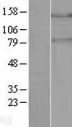 Novus Biologicals&trade;&nbsp;PASK Overexpression Lysate