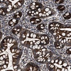 PASK Antibody, Novus Biologicals 25 &mu;L; Unlabeled:Antibodies, Polyclonal