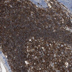 PASK Antibody, Novus Biologicals:Antibodies:Primary Antibodies