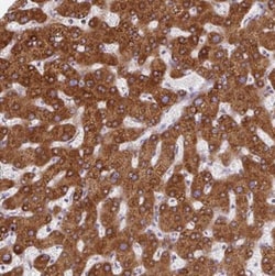 Patched Domain Containing 2 Antibody, Novus Biologicals 0.1mL; Unlabeled:Antibodies,