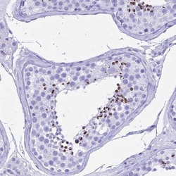 PATE4 Antibody, Novus Biologicals 0.1mL; Unlabeled:Antibodies, Polyclonal