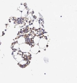 PATL1 Antibody, Novus Biologicals:Antibodies:Primary Antibodies